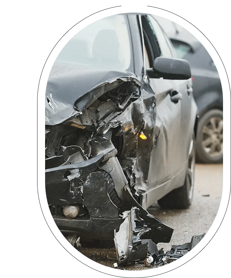 What to do After Car Crash